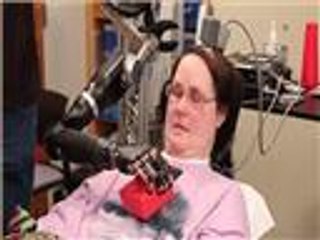 ابتكار ذراع آلية تتحرك بمجرد التفكير