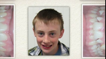 Maxfield - Orthodontists Cottonwood Heights - 801.263.1333