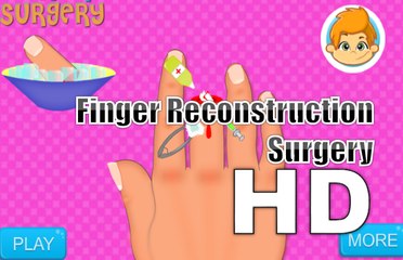 Doctor Surgery Games - Finger reconstruction surgery Game - Gameplay Walkthrough