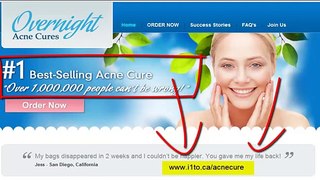 Cure acne for good back acne, blemishes ,pimples,rosacea,vulgaris