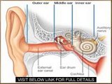 Tinnitus Natural Treatment   Tinnitus Miracle Review Guide