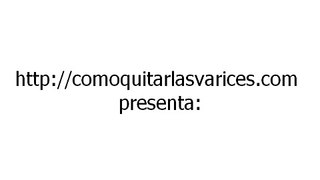 Tipos de varices y sus tratamientos caseros  - Varices Nunca Mas