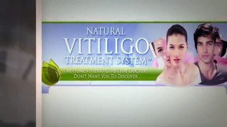 Vitiligo Symptoms - Natural Vitiligo Treatment System