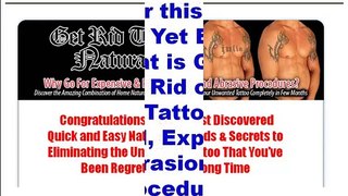 how to remove tattoos without laser - Get Rid Tattoo