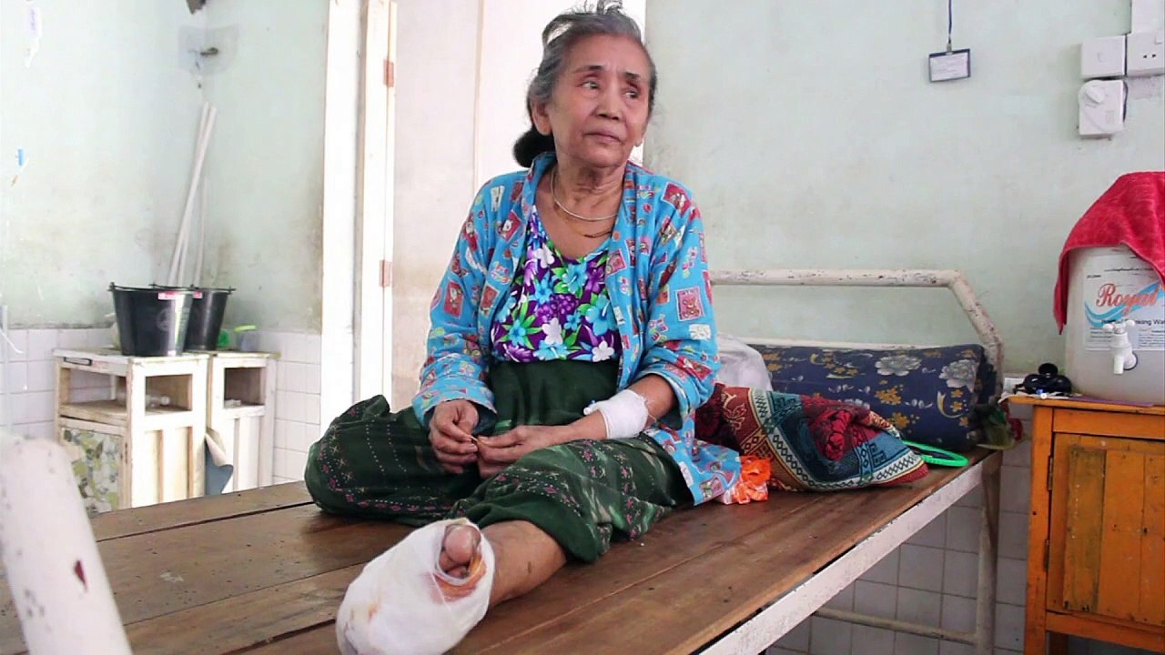 Lepra: Kampf gegen eine uralte Seuche in Myanmar