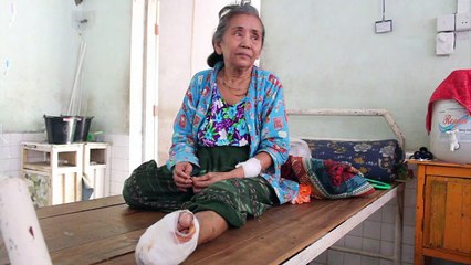 Lepra: Kampf gegen eine uralte Seuche in Myanmar