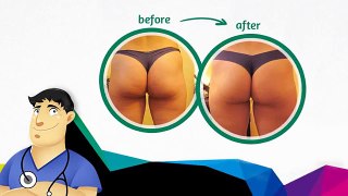 Cellulite Factor   Cellulite Factor Review   Cellulite Factor Review