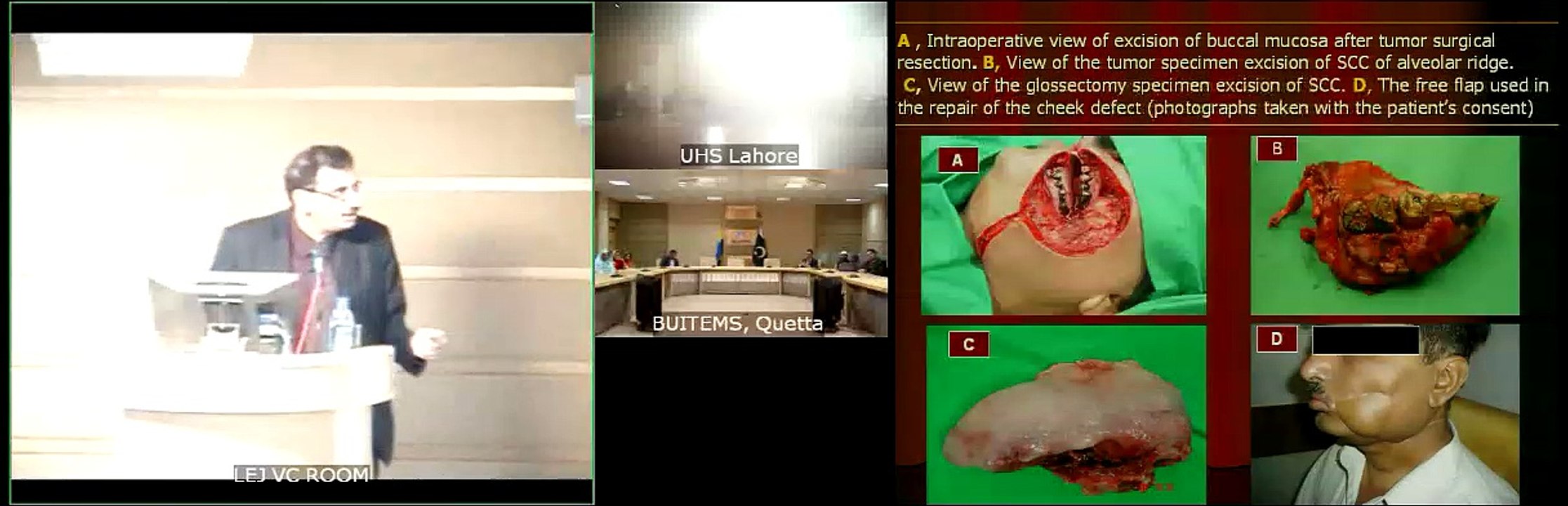 Public Awareness Seminar on “Oral Cancer” 31 Jan 13 - LEJ4Learning