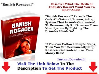 Live Rosacea Free Facts Bonus + Discount