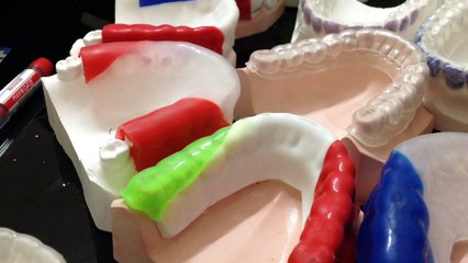 Types Of Colored Dental Sports Guards Part-I