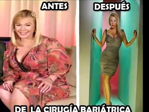La Cirugía Bariátrica y Obesidad, Para Perder Peso