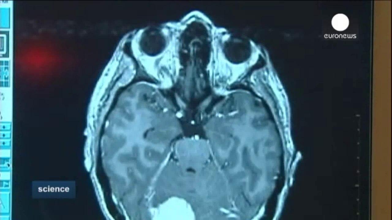 Neuropsicologia: Bebes prematuros (Anita Montagna)