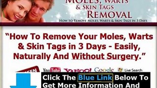 Moles Warts Skin Tags Removal Ebook + Moles Warts Removal