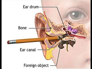 Tinnitus Miracle -- Hear Clearly Now