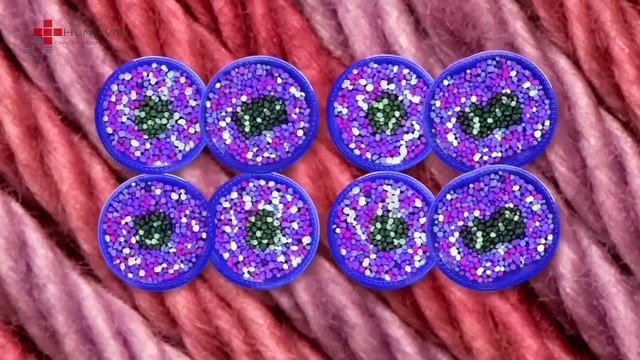 Hãy hiểu đúng về ung thư - BVUB Hưng việt số 34 Đại cồ việt (1)