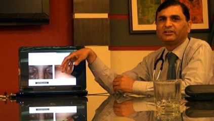 Diabetes Session On Metabolic Syndrome BY Dr Javed Part 8