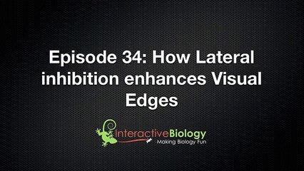 Anatomy of eye part 10