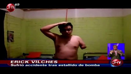 Ex soldado mutilado por bomba subió video donde acusa abandono del ejército - CHV Noticias