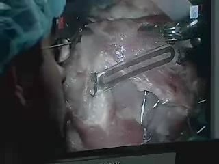 Discover Cutting-Edge Robotic Surgery at Carnegie Mellon with VOA 🎥