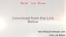 Banish Tonsil Stones 2.0 Review, does it work (instrant access)