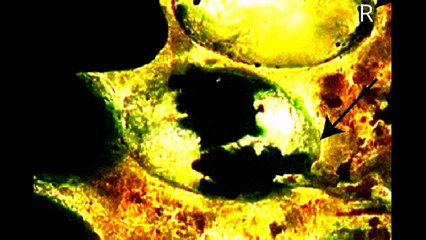 TAPEWORMS EGGS 270 MILLION YRS OLD FOUND IN SHARK FOSSIL