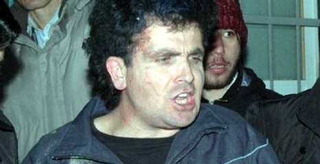 Hastane Çıkışında Dolmabahçe Bombacısından Dikkat Çeken Slogan