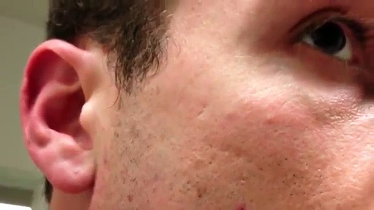 Man shaves his beard off but he got terrified