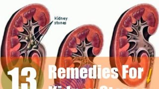 kidney stone relief at home THIS IS THE EASY kidney stone remedy 123