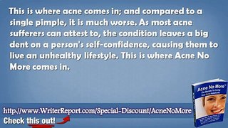 Acne No More Full Version Download - Acne No More DVD