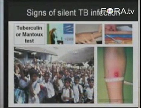 Christopher Dye on Disease Persistence Through History