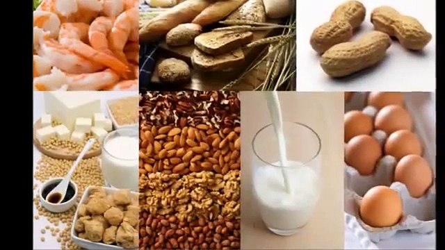 urticaria treatment How To Get Rid Of Hives FAST! - Best Hives Treatment - Get Cured In JUST 3 W