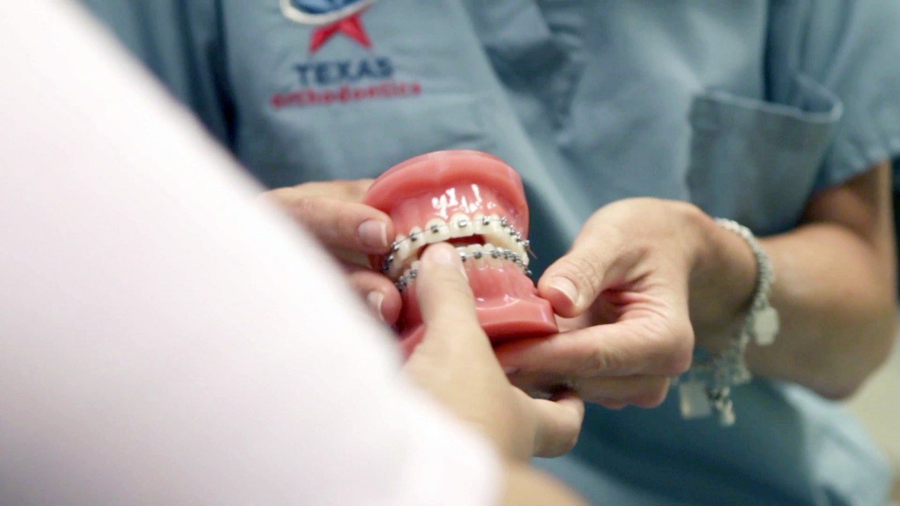 Big price difference by Texas Orthodontics