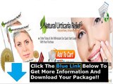 Natural Urticaria Relief Download   Natural Urticaria Relief Free Download