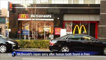 Unhappy meal: Japan McDonald's sold tooth with fries