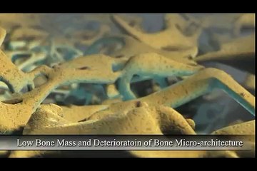 Bonton is a well researched & tested product for its efficacy in improving bone mineralization