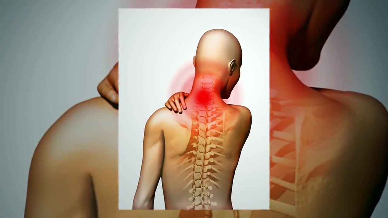 Neck Pain Frisco TX | Call 972-584-0833