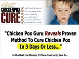 Fast Chicken Pox Cure
