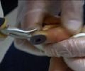 Parmağına düğme bastı