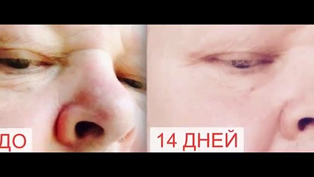 Красота и молодость лица