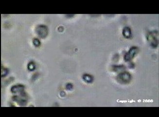 ORGONE-ENERGY-SCHOOL-Chapter-1-Tension-and-Charge