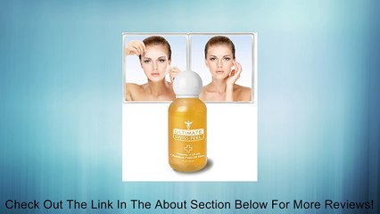 Ultimate Swiss Peel (Glycolic Acid Exfoliator) Review