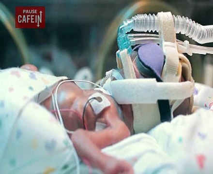 Les premiers jours d'un bébé prématuré né à 5 mois et demi, impressionnant...