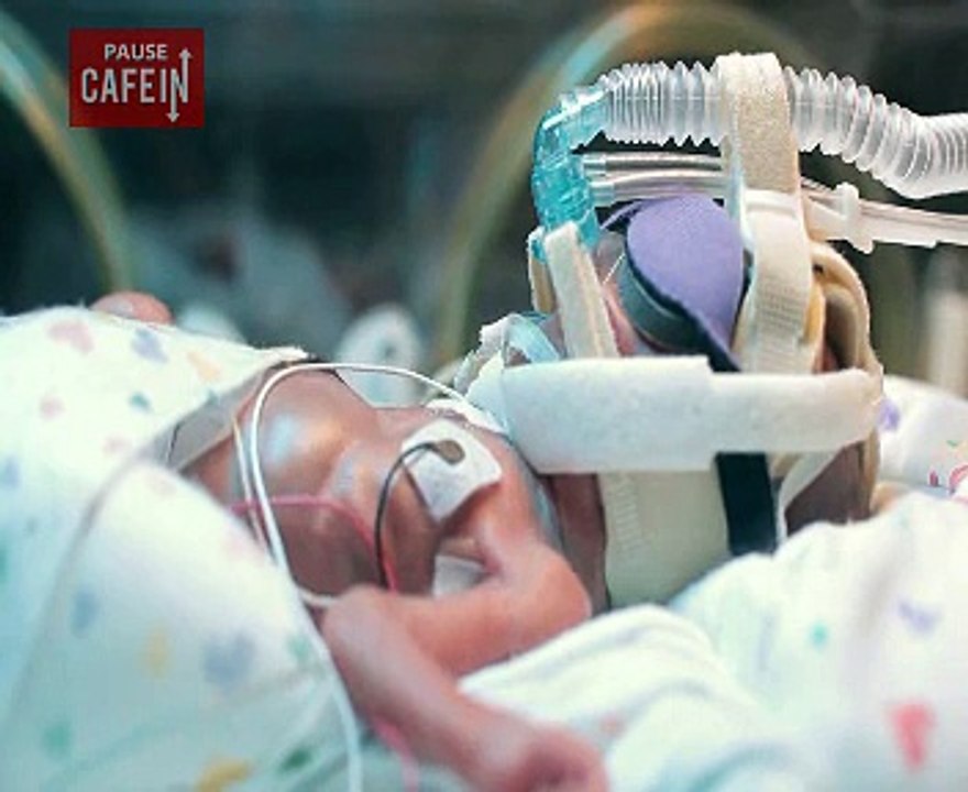 Les premiers jours d'un bébé prématuré né à 5 mois et demi, impressionnant...