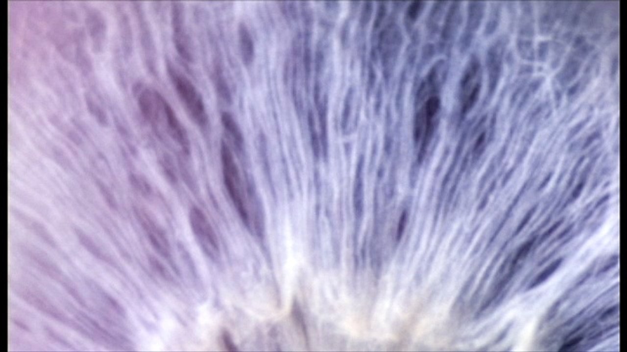 Institut National du Cancer (Inca) - lutte contre le cancer, "Recherche sur les cancers, tout s'accélère" - janvier 2012 - teaser, "L'oeil"