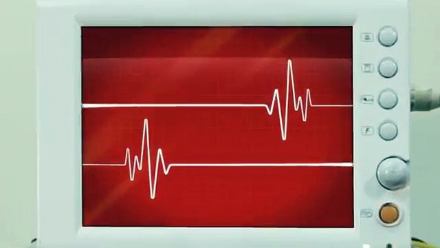 Durex - préservatifs Ultra Thin Feel, Intensely close, ECG , Car parking Climax - février 2013 - ECG