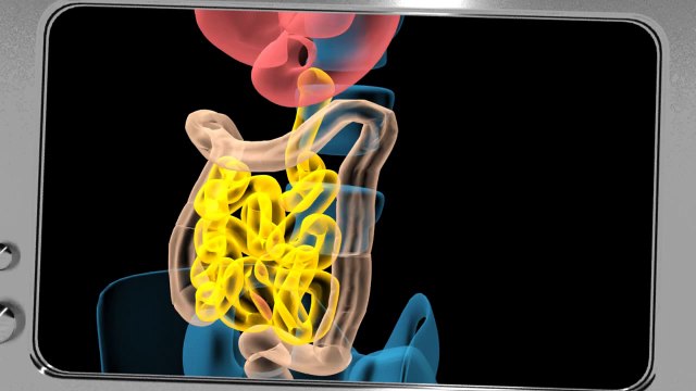 Dassault Systèmes - éditeur de logiciels - avril 2010 - The Collaborative Tribe , Surprising Inside Look , rayons x