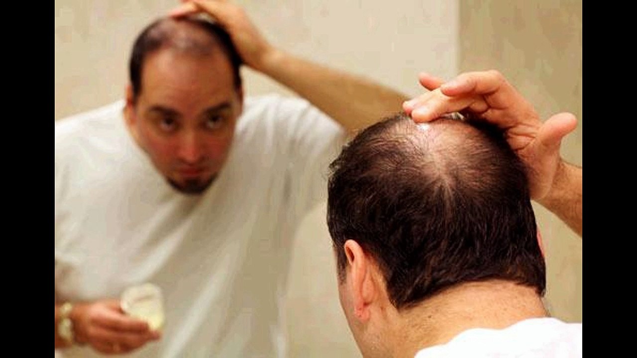 Alopecia Hair Growth Remedy | Hair Loss Protocol