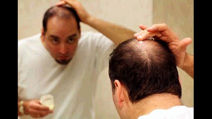 Alopecia Hair Growth Remedy | Hair Loss Protocol