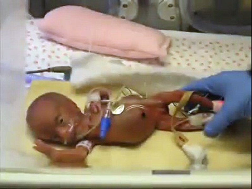 This Miracle Baby's Story Will Melt Your Heart