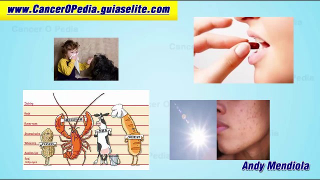 Alergias en la piel - Que sintomas presentan y como puedes tratarlas?